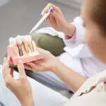 dental implants consultation, model of dental implants