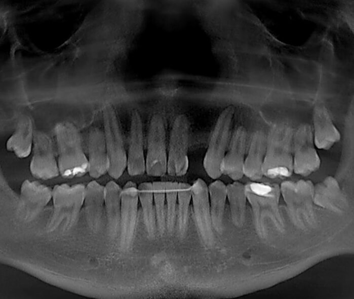 dental x-ray