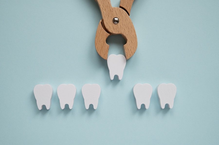 tooth extraction recovery