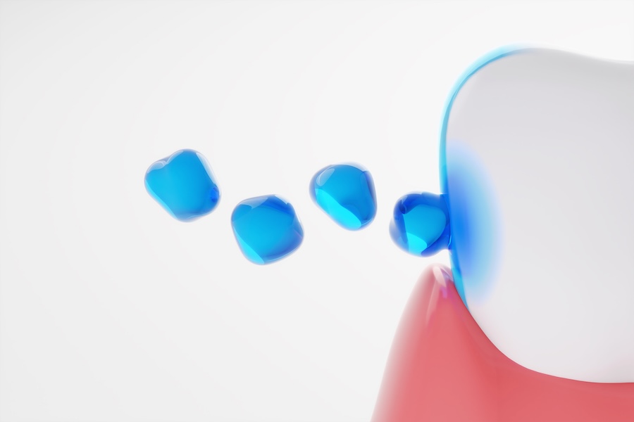 fluorid treatments for adults